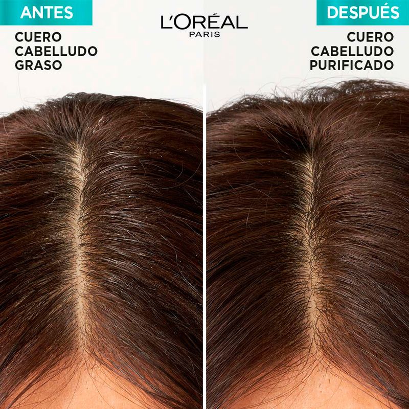 Acondicionador-Elvive-L-or-al-Paris-Hialuronico-Pure-750ml-6-45634