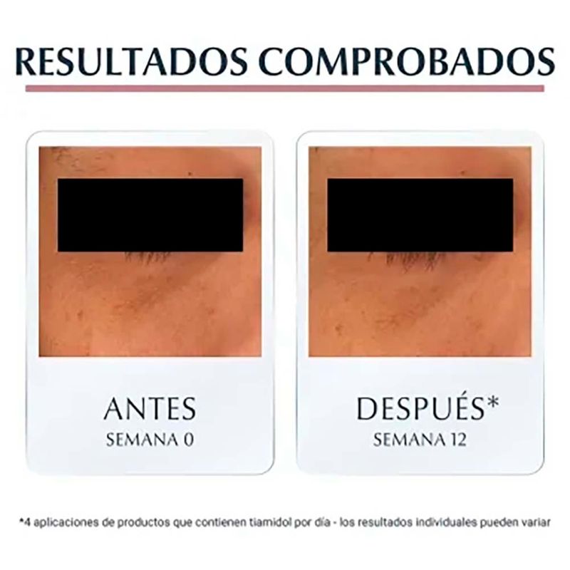 Contorno-De-Ojos-Eucerin-Anti-Pigment-15ml-4-56330