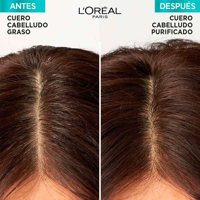 Shampoo-Elvive-Hialuronico-Pure-200ml-4-45629